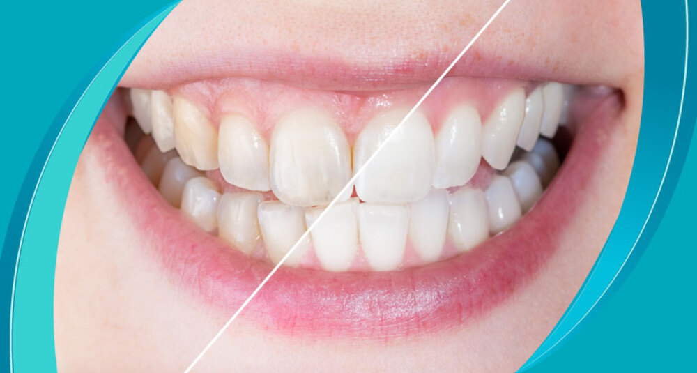 support enamel strength and cavity prevention